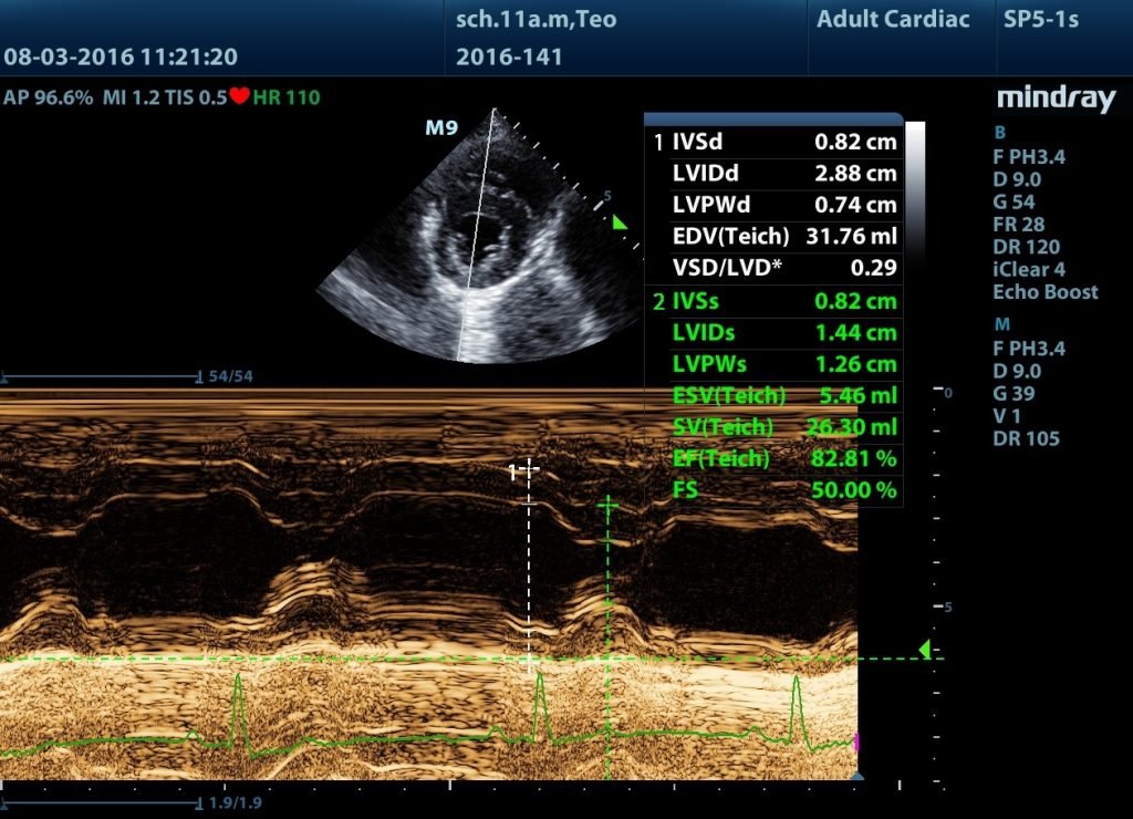 Imagen ecográfica. Ecografía cardiaca